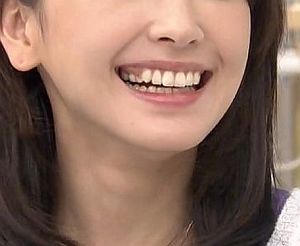 新垣結衣の歯