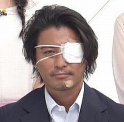 山口の眼帯